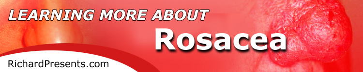 750px x 150px - Rosacea | Site Map